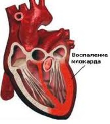 парвовирусный энтерит - влияние на сердце